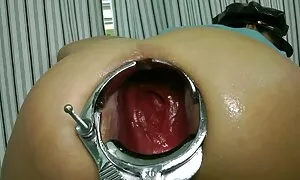 കൈമുട്ട് വരെ മമ്മിയു ...