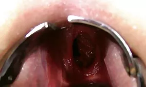 ഇരട്ട അനൽ ഫിസ്റ്റിംഗ ...