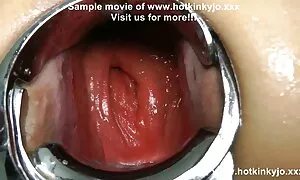 കഴുതയിൽ മലദ്വാരം സെക ...